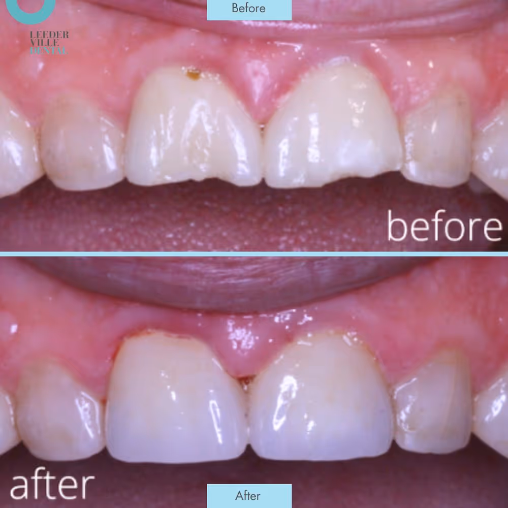 Gallery: photo 30 at Leederville Dental, Mt Hawthorn