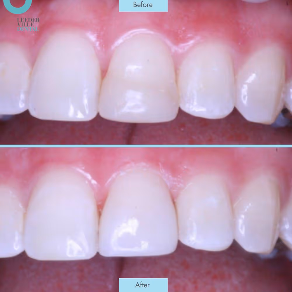 Gallery: photo 29 at Leederville Dental, Mt Hawthorn