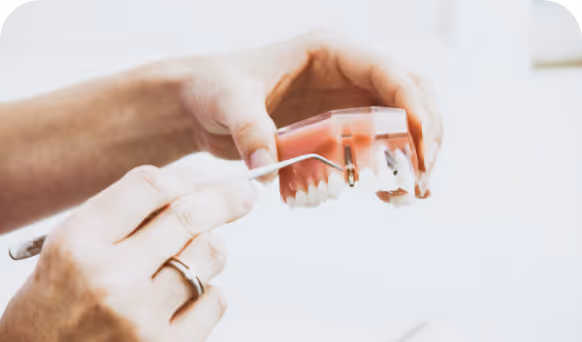 Dental Implants Leederville
