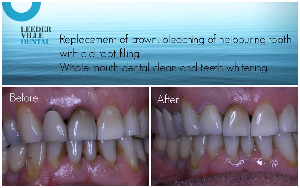 improve your smile at any age