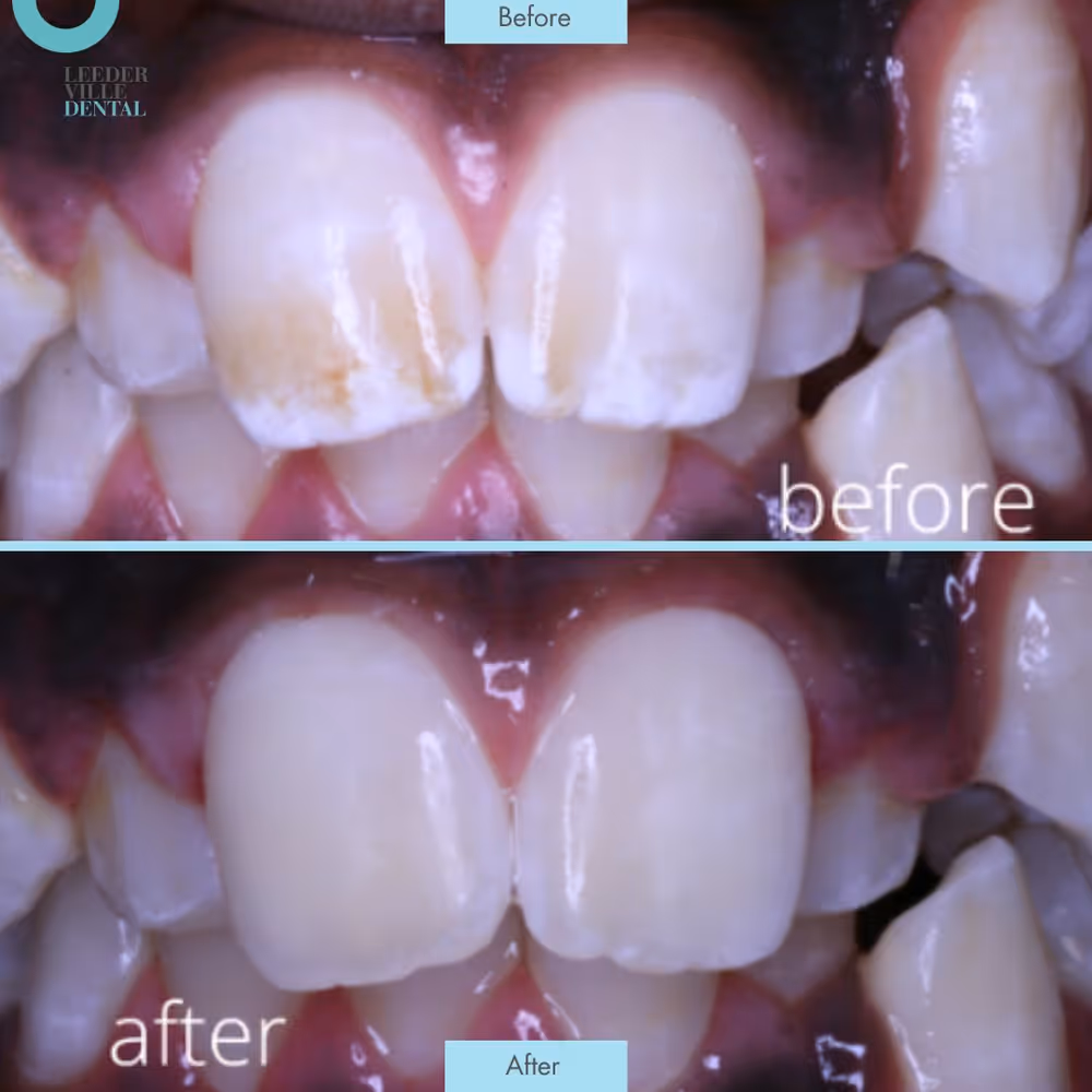 Flurosis Leederville Dental Post