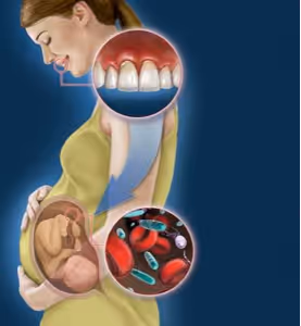 gum diseaae can affect your unborn baby
