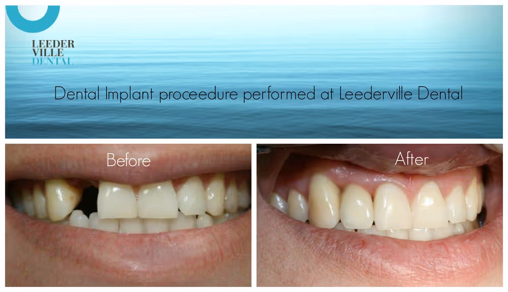 Gallery: photo 8 at Leederville Dental, Mt Hawthorn