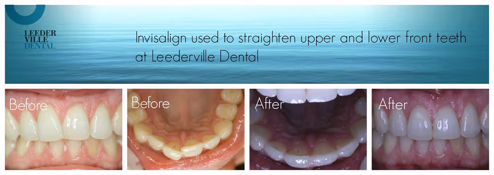 Gallery: photo 17 at Leederville Dental, Mt Hawthorn