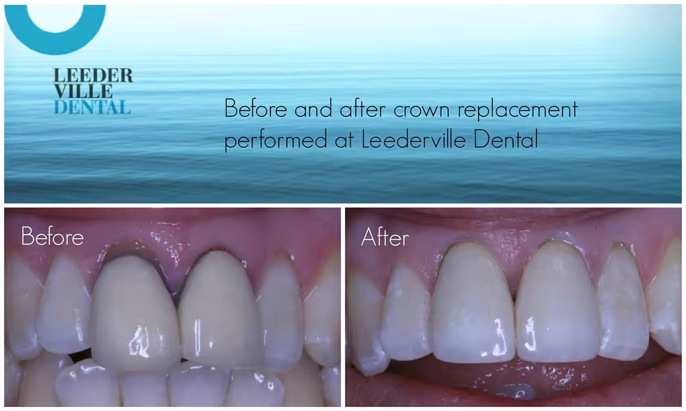 Gallery: photo 28 at Leederville Dental, Mt Hawthorn