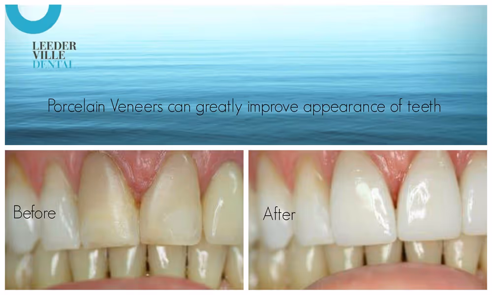 Gallery: photo 26 at Leederville Dental, Mt Hawthorn