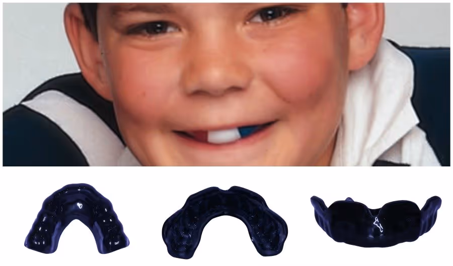 choose you mouthguard colour