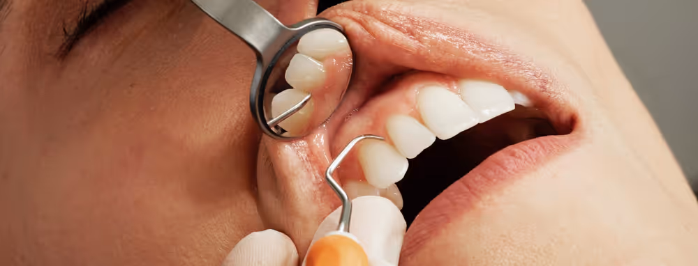 Preventative Care: photo 3 at Leederville Dental, Mt Hawthorn