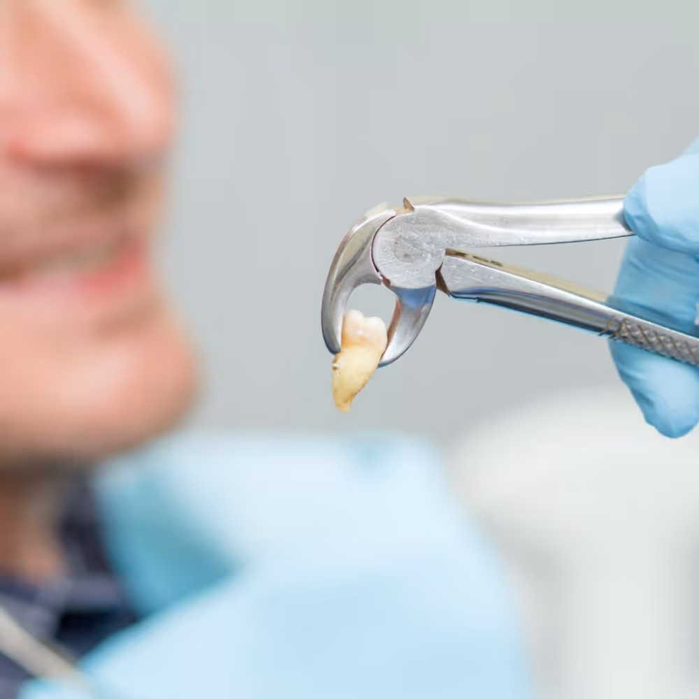 Extraction After Care: photo 1 at Leederville Dental, Mt Hawthorn