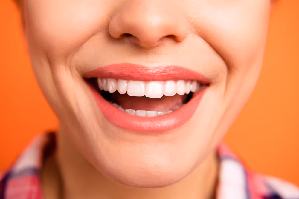 teeth whitening dental care