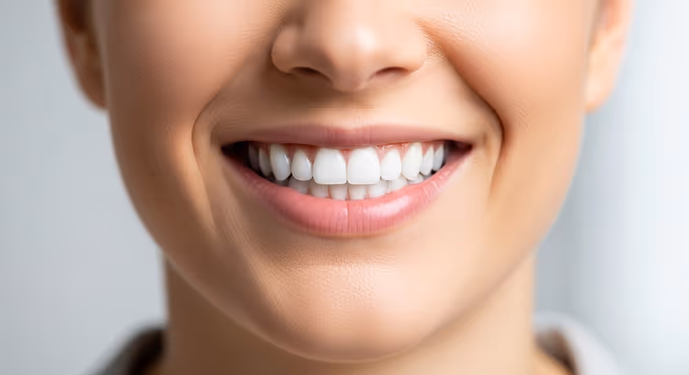 whitening spots on teeth